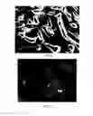 Fig. 04 - Method for Preparing Porous Metal Material and Application Thereof