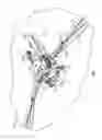 Fig. 02 - Large diameter travelling pipe cutter
