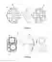 Fig. 07 - Shock-absorbing device for a humanoid robot