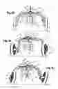Fig. 10 - Vehicle having a chassis and a pendulum nacelle