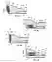 Fig. 05 - Safety restraint system with inflatable pelvis restraint device