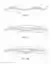 Fig. 04 - WINDSCREEN WIPER DEVICE