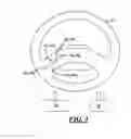 Fig. 04 - Automatically controlling vehicle speed in accordance with a set-speed
