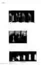 Fig. 10 - Combined-blade open flow path device and joined body thereof