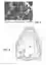 Fig. 04 - Electrical Household Appliance with Biodegradable Scale-Inhibiting Agent