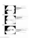Fig. 04 - METHOD FOR FUSING GLASS SUBSTRATES USING LASER BEAM AND LASER PROCESSING APPARATUS
