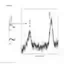 Fig. 04 - NOVEL COMPLEXES FOR THE SEPARATION OF CATIONS