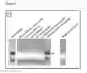 Fig. 02 - Method for reducing the DNA content of a fermentation broth
