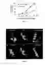 Fig. 04 - Amyloid precursor protein (APP) based Ã#-secretase inhibitor peptides, and methods of use
