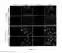 Fig. 07 - Amyloid precursor protein (APP) based Ã#-secretase inhibitor peptides, and methods of use