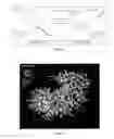 Fig. 11 - Amyloid precursor protein (APP) based Ã#-secretase inhibitor peptides, and methods of use
