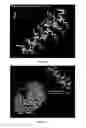 Fig. 12 - Amyloid precursor protein (APP) based Ã#-secretase inhibitor peptides, and methods of use