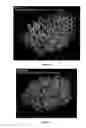 Fig. 13 - Amyloid precursor protein (APP) based Ã#-secretase inhibitor peptides, and methods of use