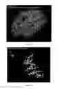 Fig. 14 - Amyloid precursor protein (APP) based Ã#-secretase inhibitor peptides, and methods of use