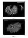 Fig. 15 - Amyloid precursor protein (APP) based Ã#-secretase inhibitor peptides, and methods of use