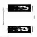 Fig. 05 - Compositions and methods for treating fatty tissue buildup
