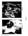 Fig. 10 - Compositions and methods for treating fatty tissue buildup