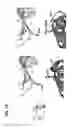 Fig. 23 - METHODS TO MANIPULATE ALPHA-FETOPROTEIN (AFP)