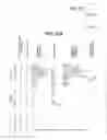 Fig. 17 - HUMANIZED ANTI-BETA7 ANTAGONISTS AND USES THEREFOR
