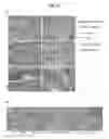Fig. 15 - Serum-free medium