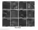 Fig. 06 - CONVERSION OF SOMATIC CELLS INTO NOCICEPTORS, AND METHODS OF USE THEREOF