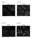 Fig. 09 - Differentiation of human embryonic stem cells into pancreatic endocrine cells