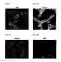 Fig. 10 - Differentiation of human embryonic stem cells into pancreatic endocrine cells