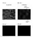 Fig. 11 - Differentiation of human embryonic stem cells into pancreatic endocrine cells