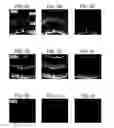 Fig. 03 - Adeno-associated virus virions with variant capsid and methods of use thereof