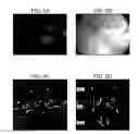 Fig. 06 - Adeno-associated virus virions with variant capsid and methods of use thereof