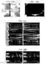 Fig. 13 - Adeno-associated virus virions with variant capsid and methods of use thereof