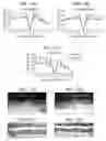 Fig. 16 - Adeno-associated virus virions with variant capsid and methods of use thereof