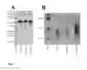 Fig. 02 - Amylase variants having reduced disposition to form deamidation products