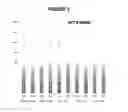 Fig. 07 - tRNA derived small RNAs (tsRNAs) involved in cell viability