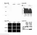 Fig. 11 - tRNA derived small RNAs (tsRNAs) involved in cell viability