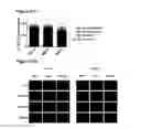 Fig. 24 - tRNA derived small RNAs (tsRNAs) involved in cell viability