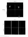 Fig. 03 - Methods for producing enteroendocrine cells that make and secrete insulin