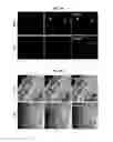 Fig. 05 - Methods for producing enteroendocrine cells that make and secrete insulin