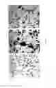 Fig. 37 - METHODS AND COMPOSITIONS FOR THE TREATMENT OF CANCER