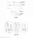 Fig. 03 - METHODS AND COMPOSITIONS FOR DETECTING ANTI-DRUG ANTIBODIES