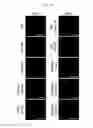 Fig. 16 - REACTIVATION OF X CHROMOSOME GENES