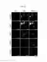 Fig. 40 - REACTIVATION OF X CHROMOSOME GENES