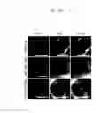 Fig. 48 - REACTIVATION OF X CHROMOSOME GENES