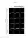Fig. 56 - REACTIVATION OF X CHROMOSOME GENES