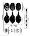 Fig. 03 - Methods of Detecting Diseases or Conditions Using Phagocytic Cells