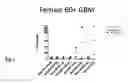 Fig. 09 - DETECTION OF BRAIN CANCER