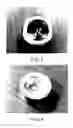 Fig. 03 - Crucible for electron-beam evaporator