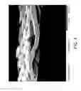 Fig. 05 - Conformable Microporous Fiber and Woven Fabrics Containing Same