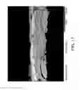 Fig. 18 - Conformable Microporous Fiber and Woven Fabrics Containing Same