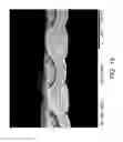 Fig. 20 - Conformable Microporous Fiber and Woven Fabrics Containing Same